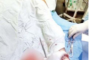 लोहिया अस्पताल में डायलिसिस यूनिट बंद, प्राइवेट अस्पताल का रुख कर रहे मरीज