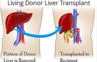 देश में पहली बार इस प्रक्रिया से हुआ सफल लिवर प्रत्यारोपण