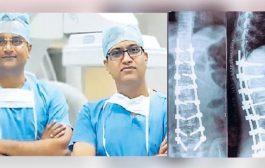 लोहिया अस्पताल की उपलब्धि : किशोरी को दो रॉड और 16 स्क्रू के सहारे दी नई जिंदगी